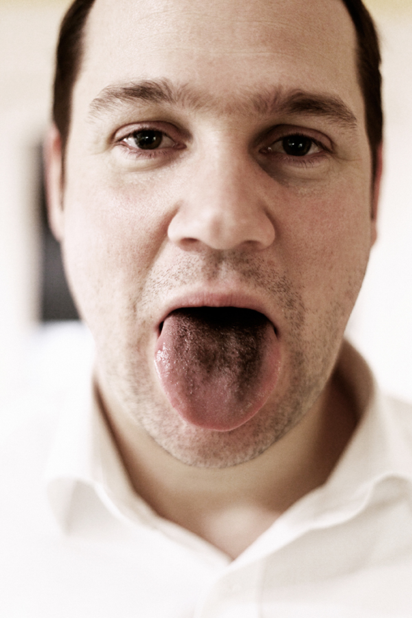 hairy tongue